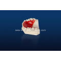 Types of Removable Orthodontic Appliances